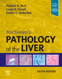 MacSween's Pathology of the Liver (Hardback) 9780702082283