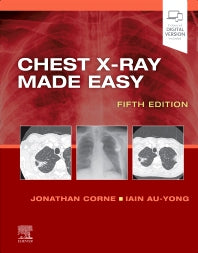 Chest X-Ray Made Easy (Paperback) 9780702082344