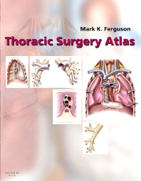 Thoracic Surgery Atlas (Hardback) 9780721603254