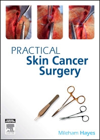 Practical Skin Cancer Surgery (Paperback) 9780729539326