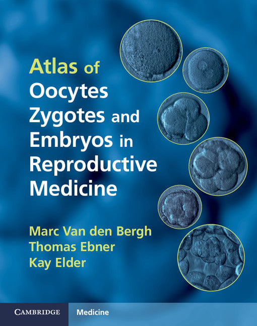 Atlas of Oocytes, Zygotes and Embryos in Reproductive Medicine Hardback with CD-ROM () 9781107004641