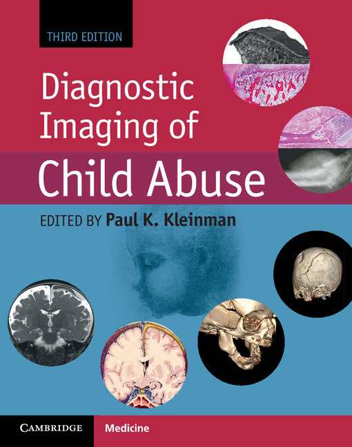 Diagnostic Imaging of Child Abuse (Hardback) 9781107010536