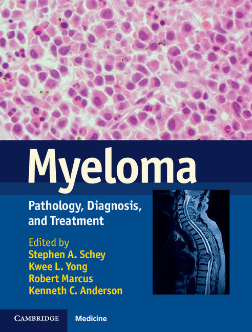 Myeloma; Pathology, Diagnosis, and Treatment (Hardback) 9781107010574