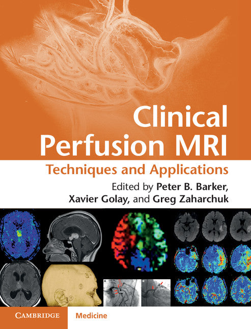 Clinical Perfusion MRI; Techniques and Applications (Hardback) 9781107013391