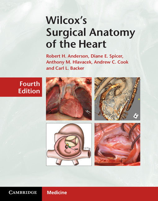 Wilcox's Surgical Anatomy of the Heart (Hardback) 9781107014480