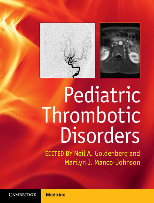 Pediatric Thrombotic Disorders (Hardback) 9781107014541