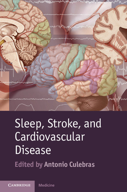 Sleep, Stroke and Cardiovascular Disease (Hardback) 9781107016415