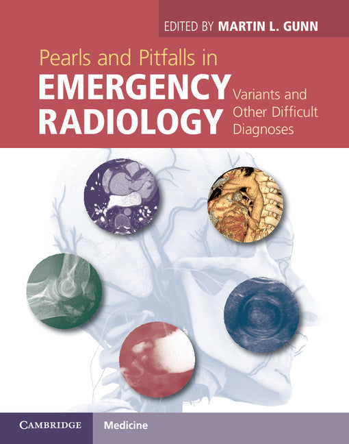 Pearls and Pitfalls in Emergency Radiology; Variants and Other Difficult Diagnoses (Hardback) 9781107021914