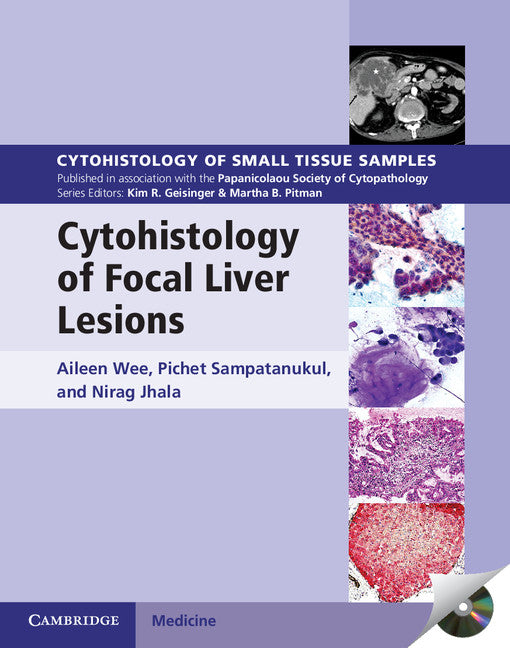 Cytohistology of Focal Liver Lesions () 9781107024175