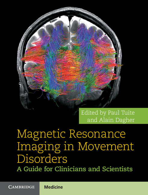 Magnetic Resonance Imaging in Movement Disorders; A Guide for Clinicians and Scientists (Hardback) 9781107026360