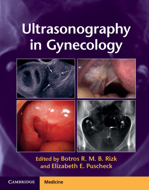 Ultrasonography in Gynecology (Hardback) 9781107029743