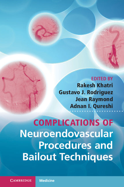 Complications of Neuroendovascular Procedures and Bailout Techniques (Hardback) 9781107030022