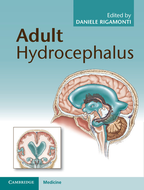 Adult Hydrocephalus (Hardback) 9781107031777