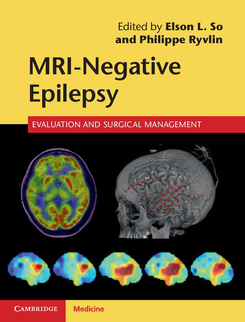 MRI-Negative Epilepsy; Evaluation and Surgical Management (Hardback) 9781107034235