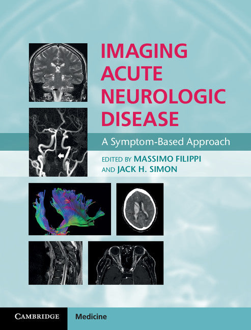 Imaging Acute Neurologic Disease; A Symptom-Based Approach (Hardback) 9781107035942