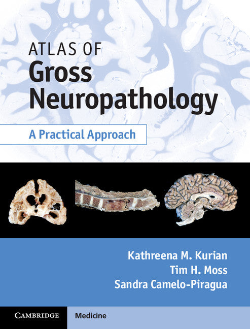 Atlas of Gross Neuropathology Book and Online Bundle; A Practical Approach () 9781107038165
