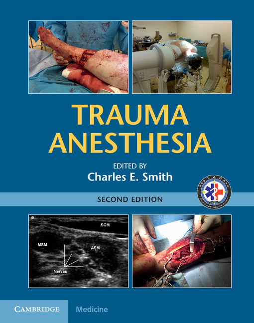 Trauma Anesthesia (Hardback) 9781107038264