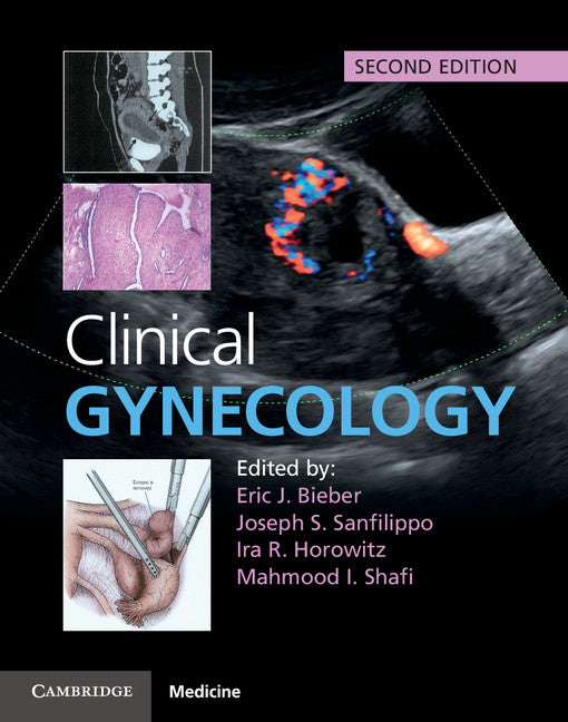 Clinical Gynecology (Hardback) 9781107040397