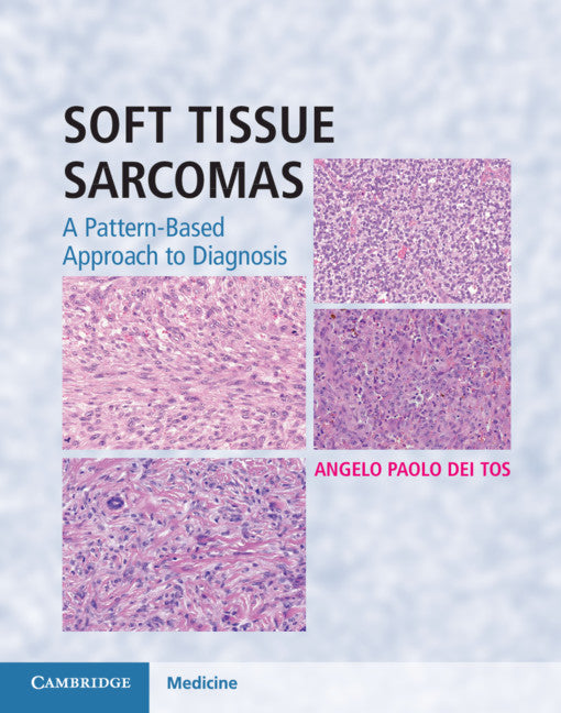 Soft Tissue Sarcomas Hardback with Online Resource; A Pattern-Based Approach to Diagnosis () 9781107040809
