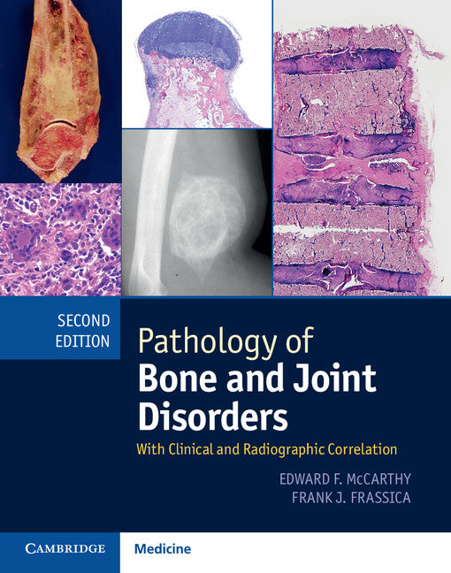 Pathology of Bone and Joint Disorders Print and Online Bundle; With Clinical and Radiographic Correlation () 9781107041233