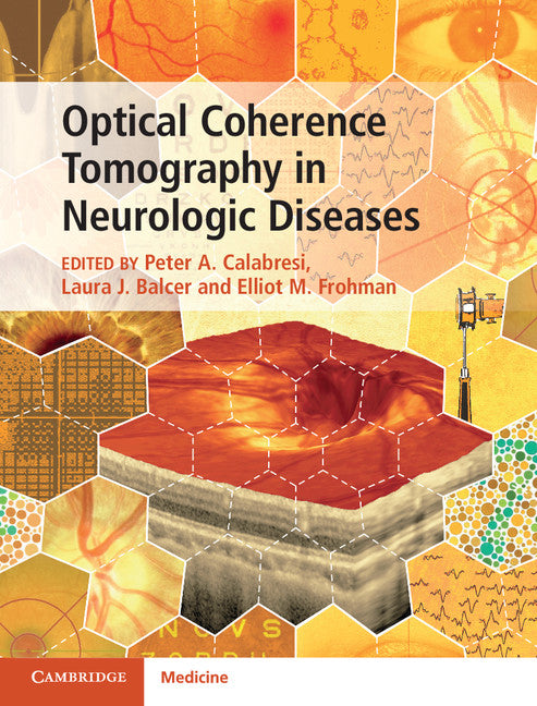 Optical Coherence Tomography in Neurologic Diseases (Hardback) 9781107041301