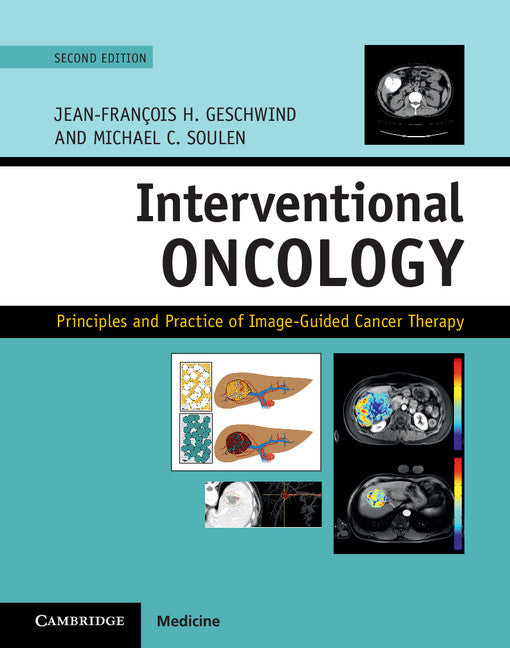 Interventional Oncology; Principles and Practice of Image-Guided Cancer Therapy (Hardback) 9781107043473