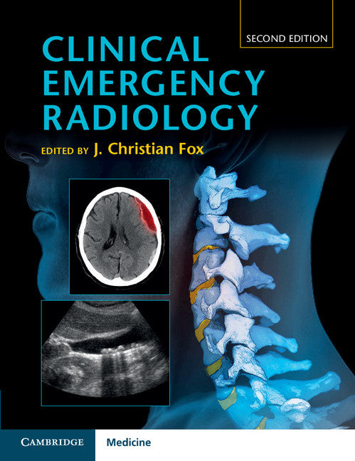 Clinical Emergency Radiology (Hardback) 9781107065796