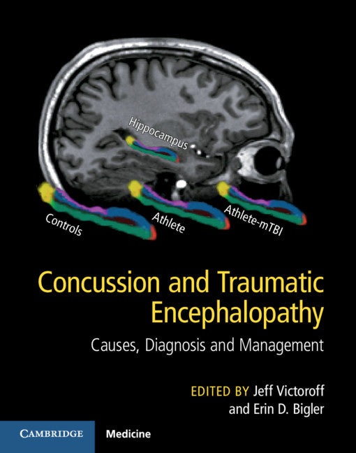 Concussion and Traumatic Encephalopathy; Causes, Diagnosis and Management (Hardback) 9781107073951