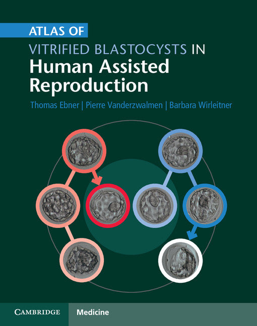 Atlas of Vitrified Blastocysts in Human Assisted Reproduction (Hardback) 9781107074095