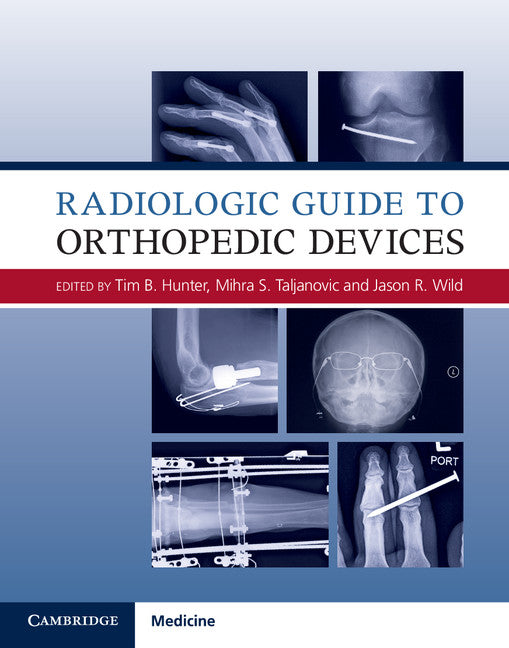 Radiologic Guide to Orthopedic Devices (Hardback) 9781107085626