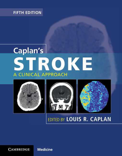 Caplan's Stroke; A Clinical Approach (Hardback) 9781107087293