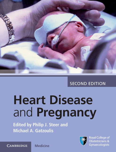 Heart Disease and Pregnancy (Hardback) 9781107095946