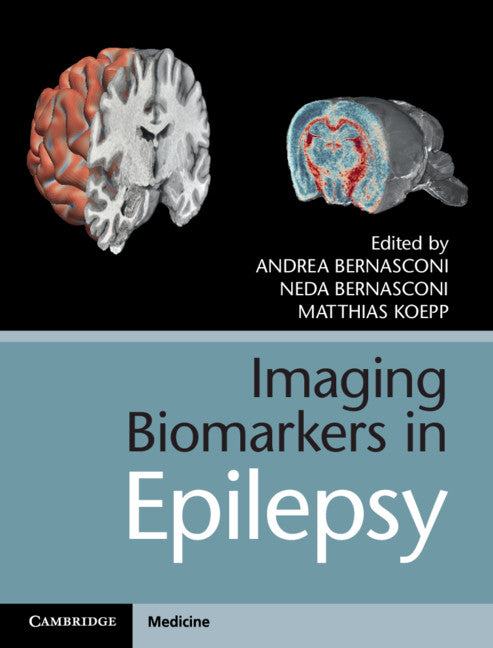 Imaging Biomarkers in Epilepsy (Hardback) 9781107108356