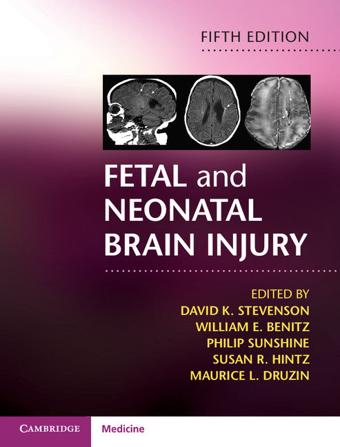 Fetal and Neonatal Brain Injury (Hardback) 9781107110809