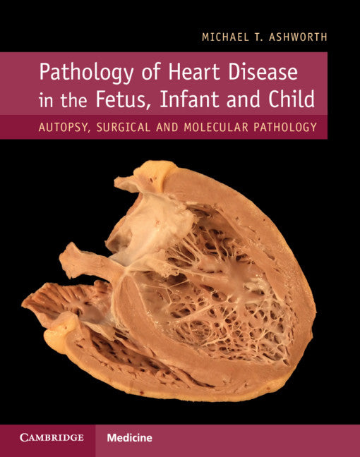 Pathology of Heart Disease in the Fetus, Infant and Child; Autopsy, Surgical and Molecular Pathology (Hardback) 9781107116283