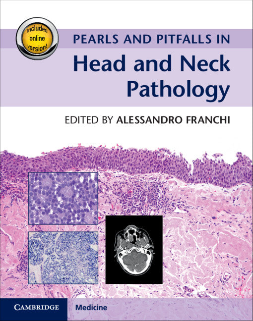 Pearls and Pitfalls in Head and Neck Pathology with Online Resource (Multiple-component retail product) 9781107123496