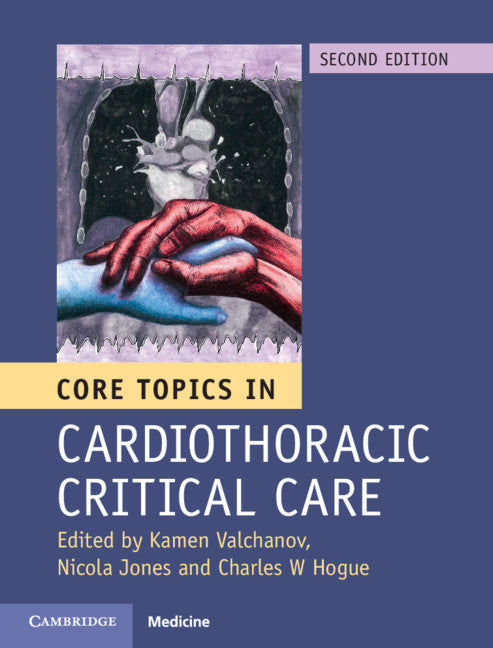 Core Topics in Cardiothoracic Critical Care (Hardback) 9781107131637