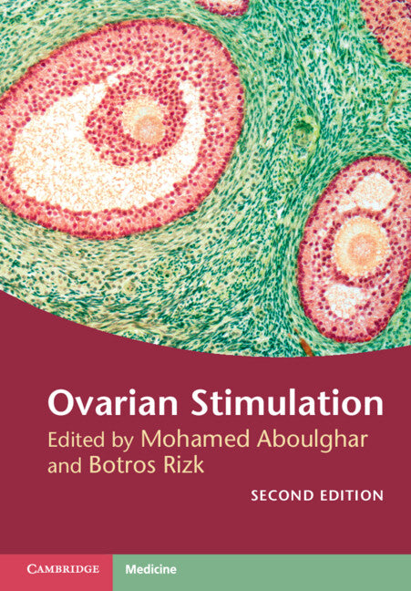 Ovarian Stimulation (Hardback) 9781107135970