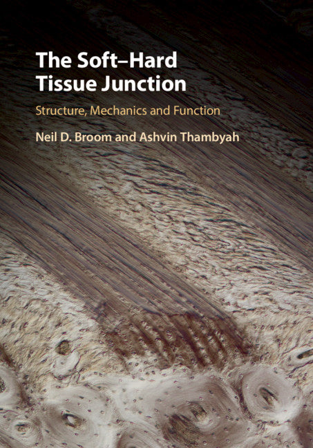 The Soft–Hard Tissue Junction; Structure, Mechanics and Function (Hardback) 9781107137868