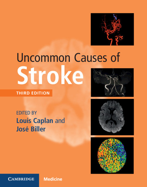 Uncommon Causes of Stroke (Hardback) 9781107147447