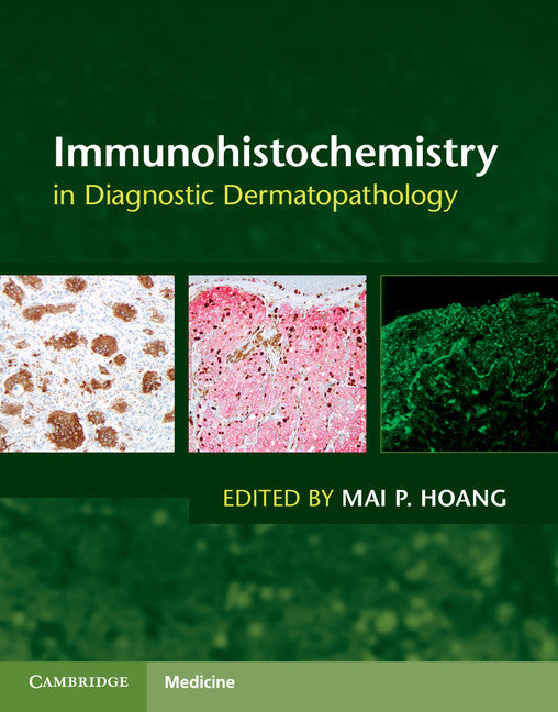 Immunohistochemistry in Diagnostic Dermatopathology (Hardback) 9781107150164