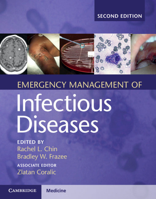 Emergency Management of Infectious Diseases (Hardback) 9781107153158