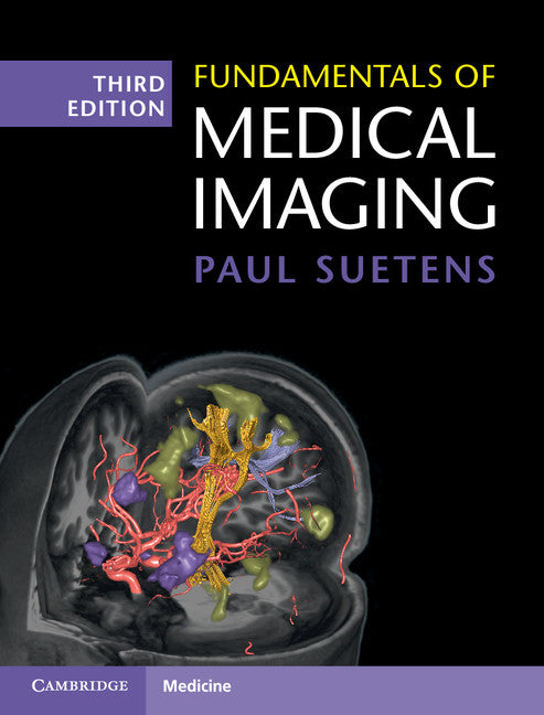 Fundamentals of Medical Imaging (Hardback) 9781107159785