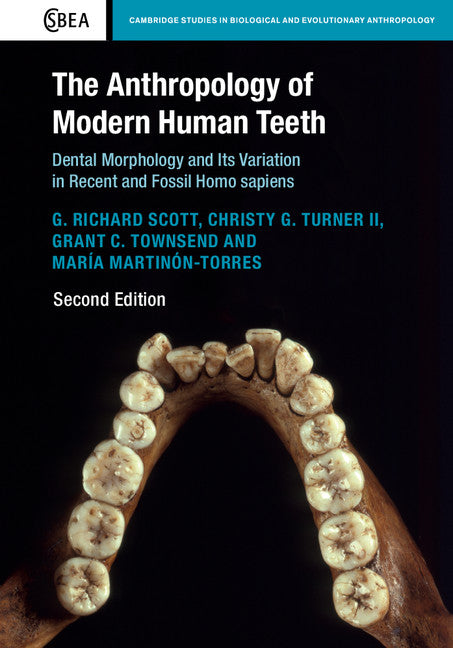 The Anthropology of Modern Human Teeth; Dental Morphology and its Variation in Recent and Fossil Homo sapiens (Hardback) 9781107174412