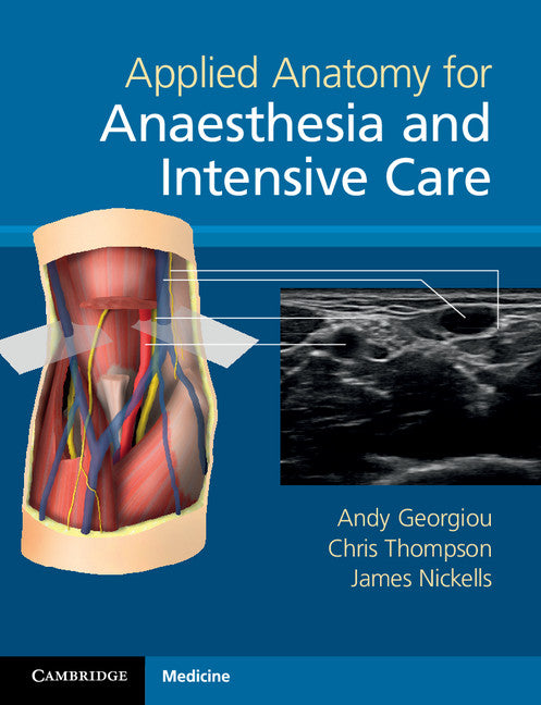 Applied Anatomy for Anaesthesia and Intensive Care (Paperback / softback) 9781107401372