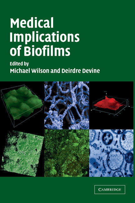 Medical Implications of Biofilms (Paperback / softback) 9781107403451