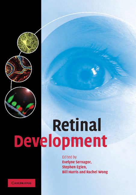 Retinal Development (Paperback / softback) 9781107411661