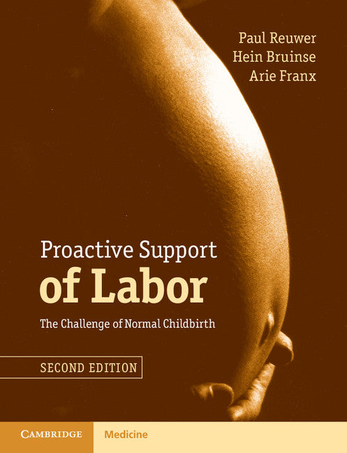 Proactive Support of Labor; The Challenge of Normal Childbirth (Paperback / softback) 9781107426580