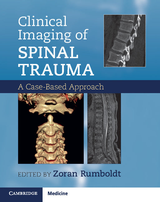 Clinical Imaging of Spinal Trauma; A Case-Based Approach (Paperback / softback) 9781107427471