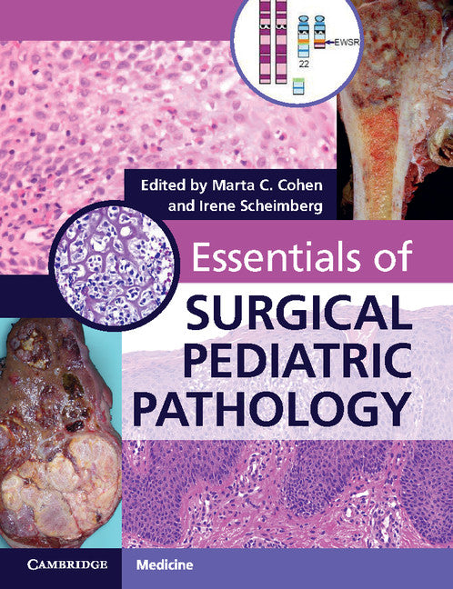 Essentials of Surgical Pediatric Pathology with DVD-ROM (Multiple-component retail product, part(s) enclosed) 9781107430808